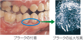 プラークの写真