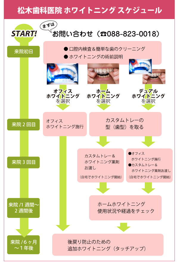 ホワイトニング・スケジュール